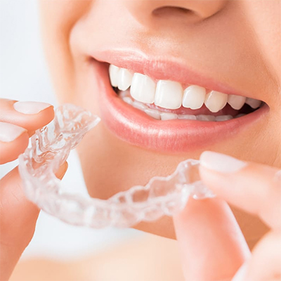 Invisalign Smileview Silvana Mattos